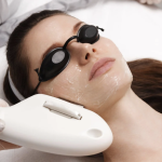 sun spot and age spot removal with lasers near Chevy Chase MD